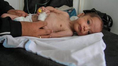 عاجل.. وزارة الصحة الفلسطينية تعلن تفشي شلل الأطفال في غزة