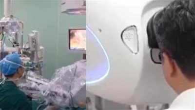 في إنجاز مذهل.. طبيب صيني يزيل ورمًا في رئة مريض من على بعد 5000 كيلومتر