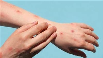 كوريا الجنوبية: تسجيل 11 حالة إصابة بفيروس 