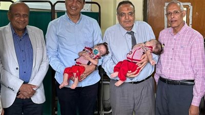 استغرقت 8 ساعات .. فريق طبي بمستشفى جامعة أسيوط ينجح في فصل توأم ملتصق 