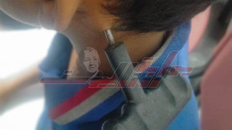 مفك حديدى يقتحم رقبة