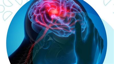 ثورة في علاج الصداع النصفي.. هل اقتربنا من الشفاء؟