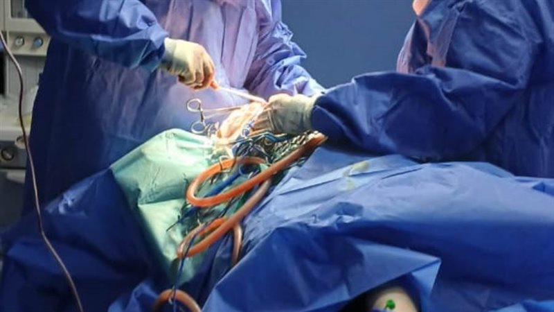 جانب من إجراء الجراحة