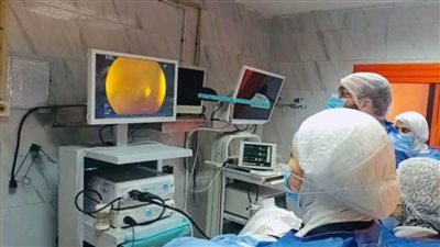 تأمين صحي بني سويف يفتت حصوات لثلاث حالات حرجة بأحدث إصدارات منظار القنوات المرارية