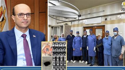 فريق طبي بمستشفيات جامعة أسيوط ينجح في إجراء عملية جراحية دقيقة لشاب يعاني من انفجار في مقلة العين 