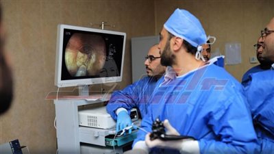 مستشفى كفر الشيخ الجامعي يطلق تقنية مناظير الفراغ الثالث لعلاج أمراض الجهاز الهضمي