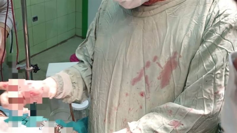 جانب من إجراء العملية