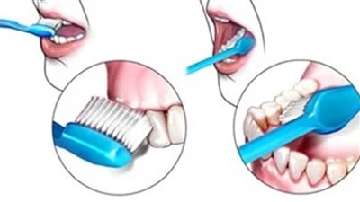 روشتة نصائح للحفاظ على صحة الأسنان والوقاية من التسوس