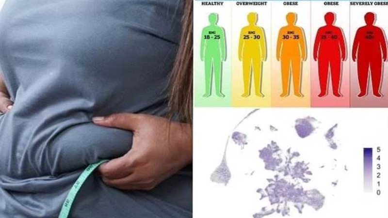 السمنة ومخاطرها