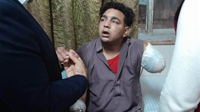 بالصور.. نائب محافظ الغربية يزور ضحية أسد سيرك طنطا