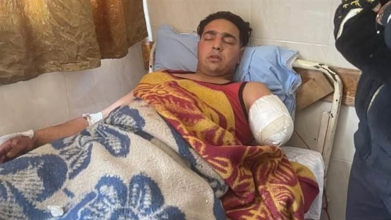 الضحية بعد بتر يده