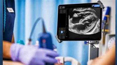 نجاح الفريق الطبي بمستشفى شرق المدينة بالإسكندرية في إنقاذ حياة مريضة شابة