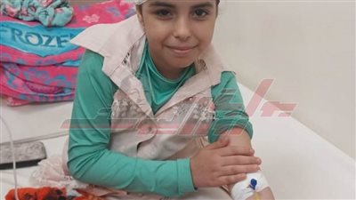 تعرضت لحادث.. جراحة نادرة بمستشفى ملوي بالمنيا تعيد طفلة للحياة بعد كسر الجمجمة
