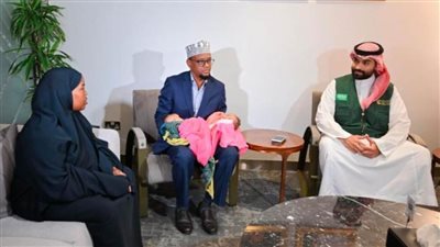 وصول التوأم الملتصق الصومالي 