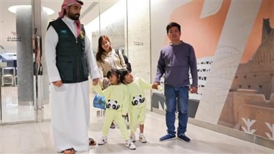 وصول التوأم الملتصق الفلبيني 