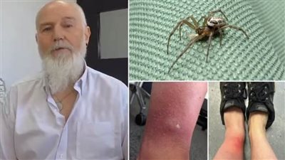 عاجل.. أخطر عنكبوت في بريطانيا يضرب هيرتفوردشاير