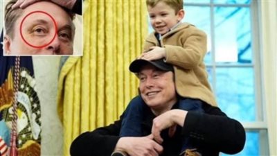 عاجل.. الذكاء الاصطناعي يكذب إيلون ماسك بشأن إصابته في عينه