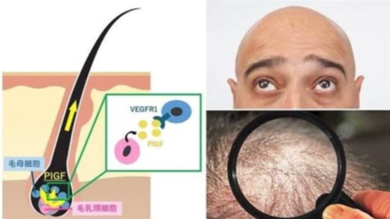 علاج تساقط الشعر