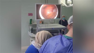 بإجراء عملية خطيرة.. أطباء مستشفى رشيد العام ينقذون حياة طفلة.. صور