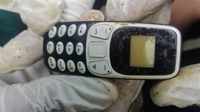 فريق طبي بمستشفى الأزهر بأسيوط يستخرج هاتفًا محمولًا من معدة مريض ابتلعه منذ عامين