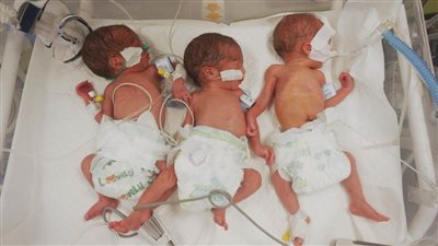 صندوق الأمم المتحدة للسكان يُحذّر من عواقب كارثية على الولادات بـ