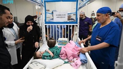 بدء عملية فصل توأم سوري ملتصق بمستشفى الملك عبدالله التخصصي للأطفال في الرياض