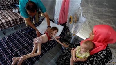 8 وفيات في غزة خلال 24 ساعة بسبب المجاعة وسوء التغذية