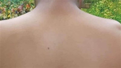 إحالة معلم للتحقيق لاعتدائه على طالب إعدادي بالفيوم بخرطوم على ظهره 