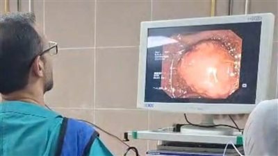 استئصال ورم دون جراحة بالقنوات المرارية بمستشفى أحمد ماهر التعليمي