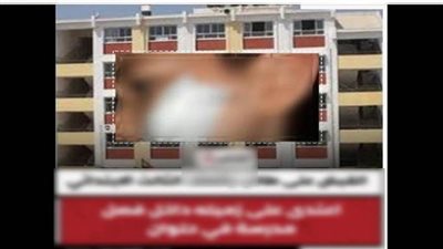 كشف ملابسات تداول تعدي طالب على آخر وإصابته بالوجه داخل مدرسة