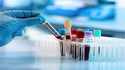 تشنجات العضلات: العلاقة بين الفيتامينات وأسبابها وطرق الوقاية