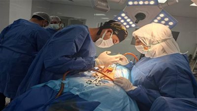 جراحة نادرة لاستئصال ورم بالعصب الحائر للمرة الأولى بمستشفيات جامعة طنطا