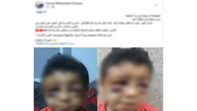 الأمن يكشف الحقيقة: لا اعتداء على طفل بمدرسة في قنا