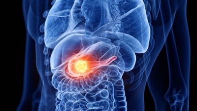 سرطان البنكرياس.. 6 علامات لا يجب تجاهلها أبدا