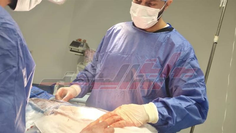 اجراء عملية جراحية