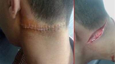 طالب يطعن زميله بـ