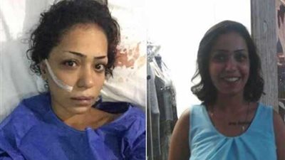 إحالة المتهم بتشويه 