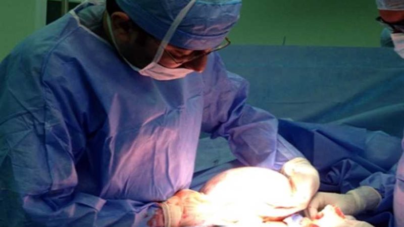 بالصور.. استئصال