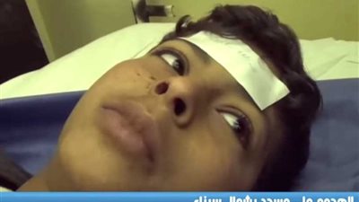 شاهد.. أطفال في المستشفى يروون شهاداتهم عن حادث مسجد 