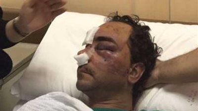 وفد صحفي مصري يزور الشاب المصري وحيد بالكويت للاطمئنان علي حالته الصحية