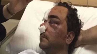 إلقاء القبض على الشخص المعتدي على المواطن وحيد رفاعي بالكويت