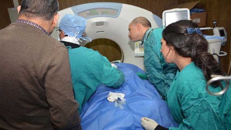 نجاح أول عملية بالصعيد