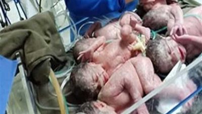 في ثاني حمل.. ولادة 5 توائم بالمستشفي العسكري