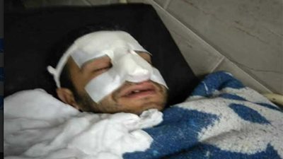 الاعتداء على طبيب بمستشفى الساحل وحبس المتهمين