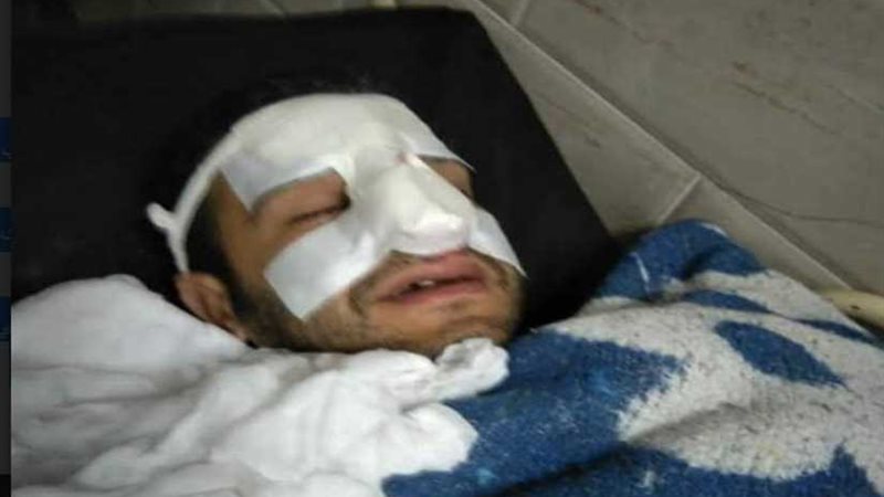 الاعتداء على طبيب