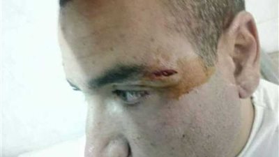 الحبس 4 أيام لأمين شرطة تعدي على طبيب بالمنوفية