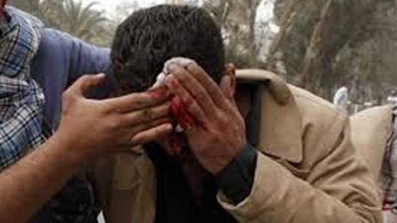 طالب يضرب زميلة بقالب