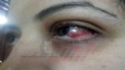 الاعتداء على سيدة أثناء دفاعها عن أطفالها.. 