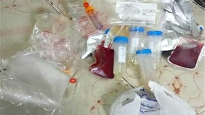 ضبط 26 قربة دم غير صالحة بـ 3 مستشفيات كبرى بالزقازيق