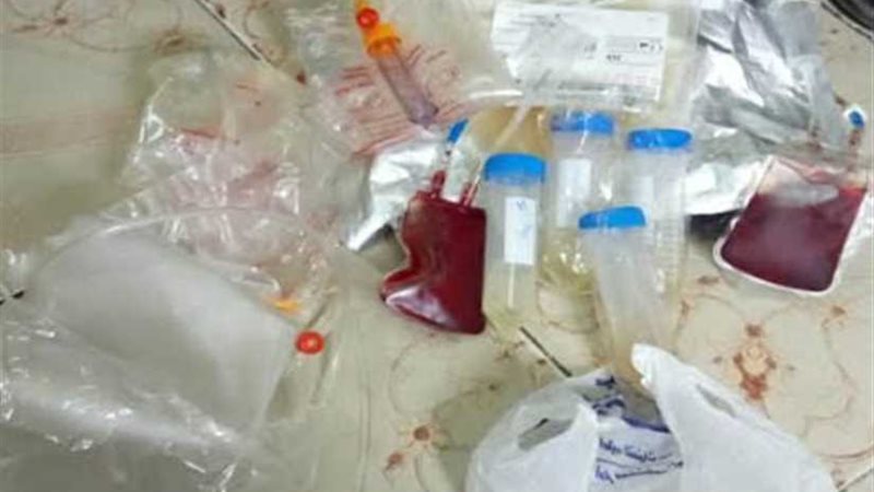 ضبط 26 قربة دم غير